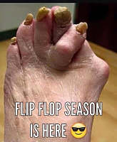 Click image for larger version

Name:	browns nasty foot.png
Views:	121
Size:	420.2 KB
ID:	2152989